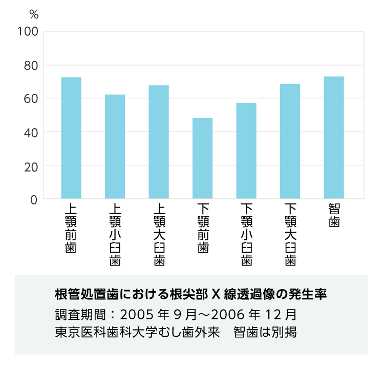 歯内療法(根管治療)画像